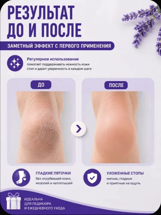 Пемза для ног двусторонняя, терка пилка для пяток и стоп, белый, фото 3