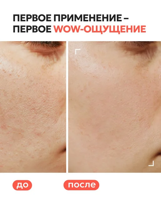 Кровавый пилинг для лица от прыщей с кислотами, 30 мл, 30 мл, фото 3