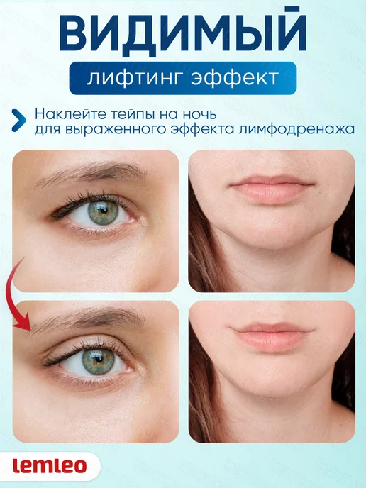 Кинезиотейп спортивный, хлопок и спандекс, 5 см × 500 см, вариант, фото 2