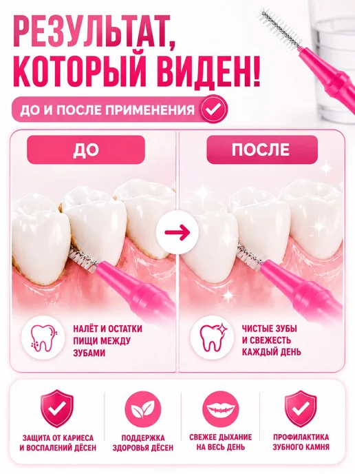 Набор межзубных ершиков 11 штук розового цвета для гигиены, розовый, фото 5
