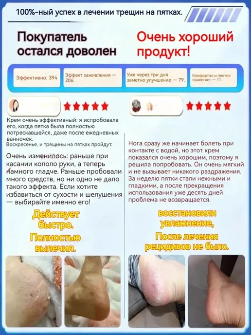 крем от трещин на пятках с мочевиной, 50 мл, фото 4