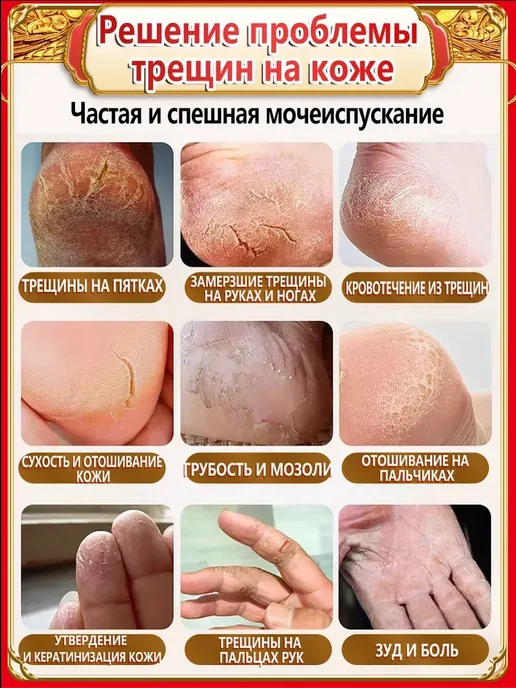 Стик-карандаш от мозолей и натоптышей, натирания, 50 мл, фото 5