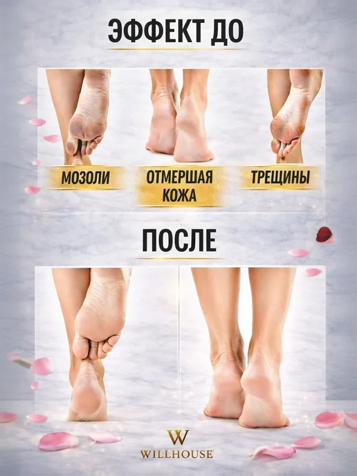 Точилка для ног, вариант, фото 2