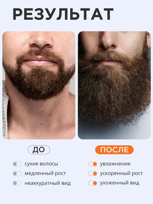 Масло для ухода за бородой, Средство для роста и увлажнения, вариант, фото 4